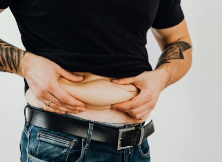 loose skin after weight loss