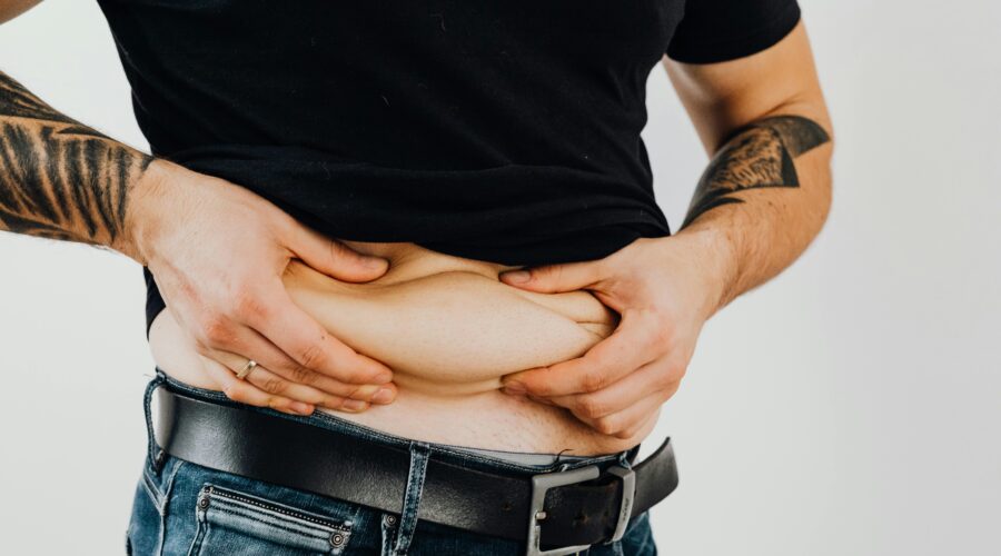 loose skin after weight loss
